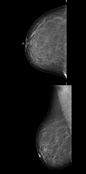 MMG with AI detection